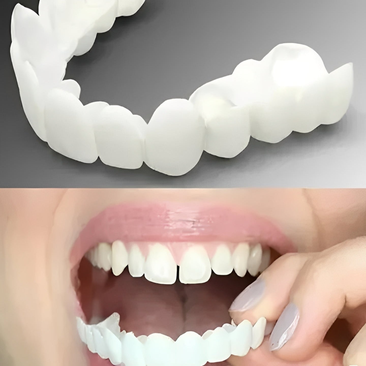 Easy Fit Clip On Smile Protector with Adjustable Strap