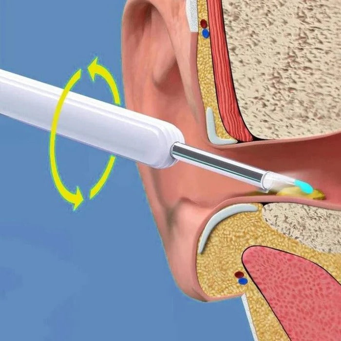 Wireless Ear Scope with LED Light Camera