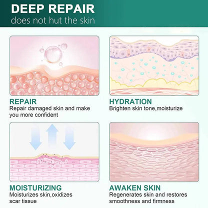 Silicone Scar Removal Cream for Fade Marks and Stretch Marks
