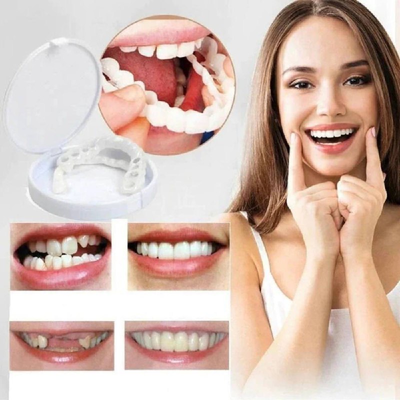 Easy Teeth Veneer Kit for Perfect Smile