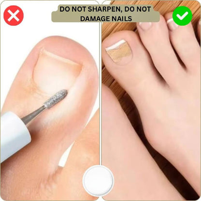 Fast Nail Fix for Broken and Ingrown Nails