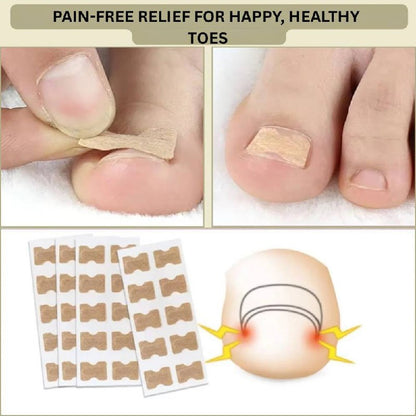 Fast Nail Fix for Broken and Ingrown Nails