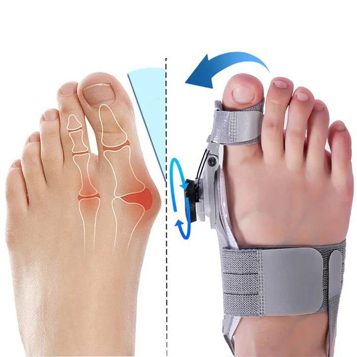 Adjustable Toe Straightener with Hinge System for Hallux Valgus Relief & Foot Alignment – Silicone Spacer for Day & Night Support