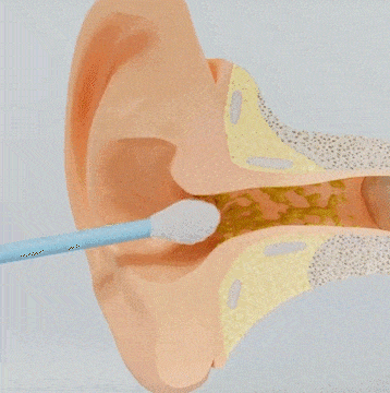 Wireless Ear Cleaning Camera with HD Scope and Silicone Tip for iPhone & Android Safe Wax Removal Tool