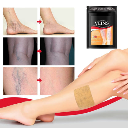 Circulation Support Patches for Legs Spider Vein Relief Swelling Reduction Botanical Formula Discreet Wear Under Clothing Post-Workout
