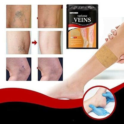 Circulation Support Patches for Legs Spider Vein Relief Swelling Reduction Botanical Formula Discreet Wear Under Clothing Post-Workout